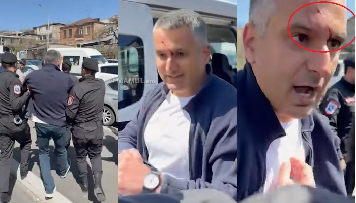 Вагинак Газарян